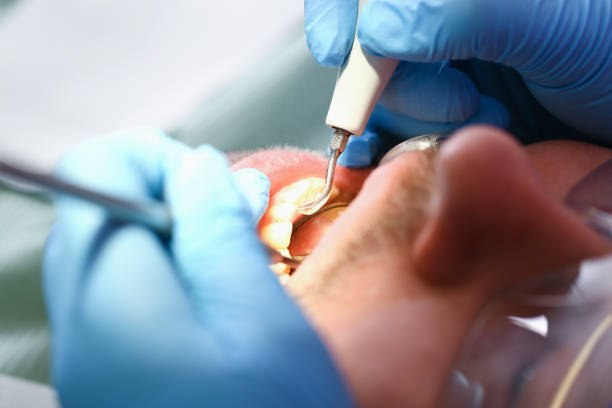 Best Emergency Treatment for Toothache in Oregon, WI